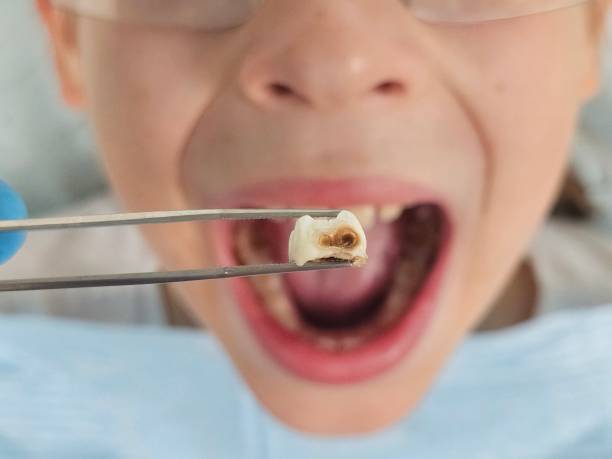 Best Emergency Treatment for Jaw Pain or Injury in New Bern, NC