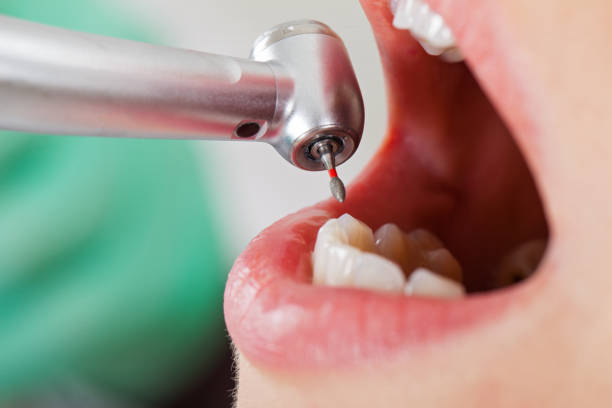 Best Emergency Root Canal Therapy in New Bern, NC